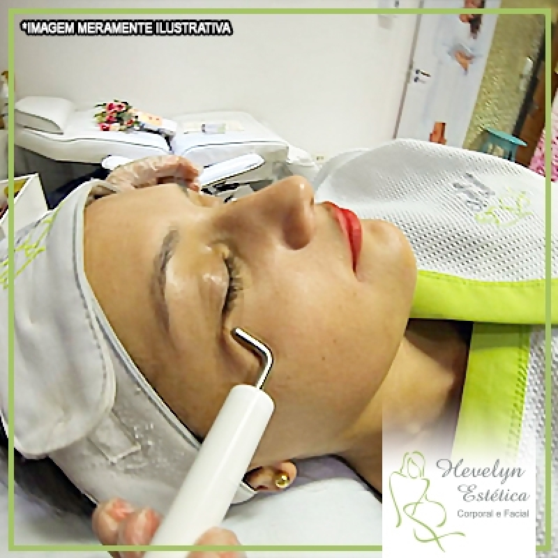 Clinica de Peeling para Tratamento do Rosto Parque Marabá - Peeling no Rosto para Acne