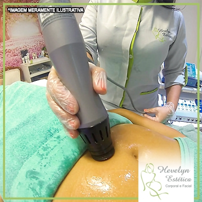 Clínica Que Faz Terapia de Ondas de Choque Parque Marabá - Tratamento Ondas de Choque Celulite