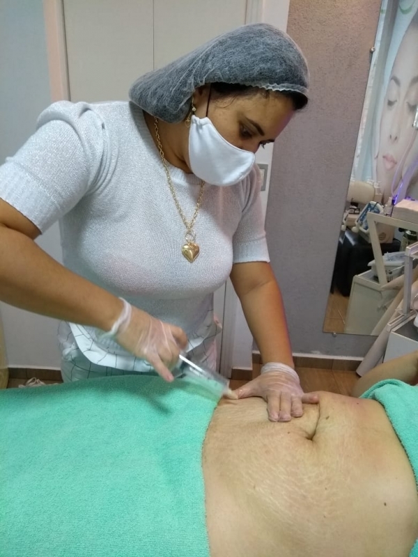 Ozonioterapia na Estética Jardim Oliveiras - Tratamento de Ozonioterapia